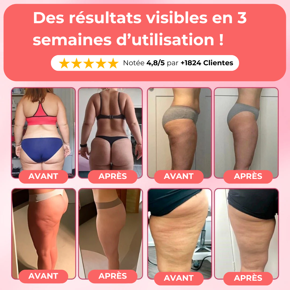 Masseur Anti-Cellulite | EvoriaSkin
